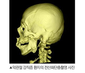 %ed%84%b1%ea%b4%80%ec%a0%88%ed%81%b4%eb%a6%ac%eb%8b%892.jpg